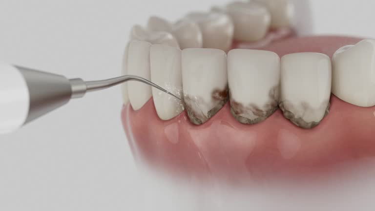 Reliable Emergency Dentist contractor in Chatfield, MN by Smile Center Dentistry